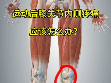 运动后膝关节内侧疼痛应该怎么办？