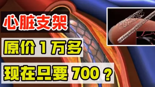 一万多的心脏支架，价格大跳水，仅仅卖700元，中国是怎么做到的