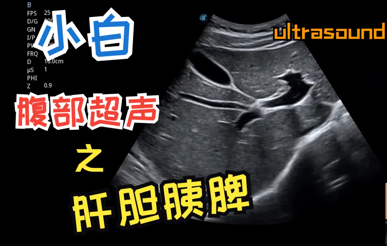 字幕下载