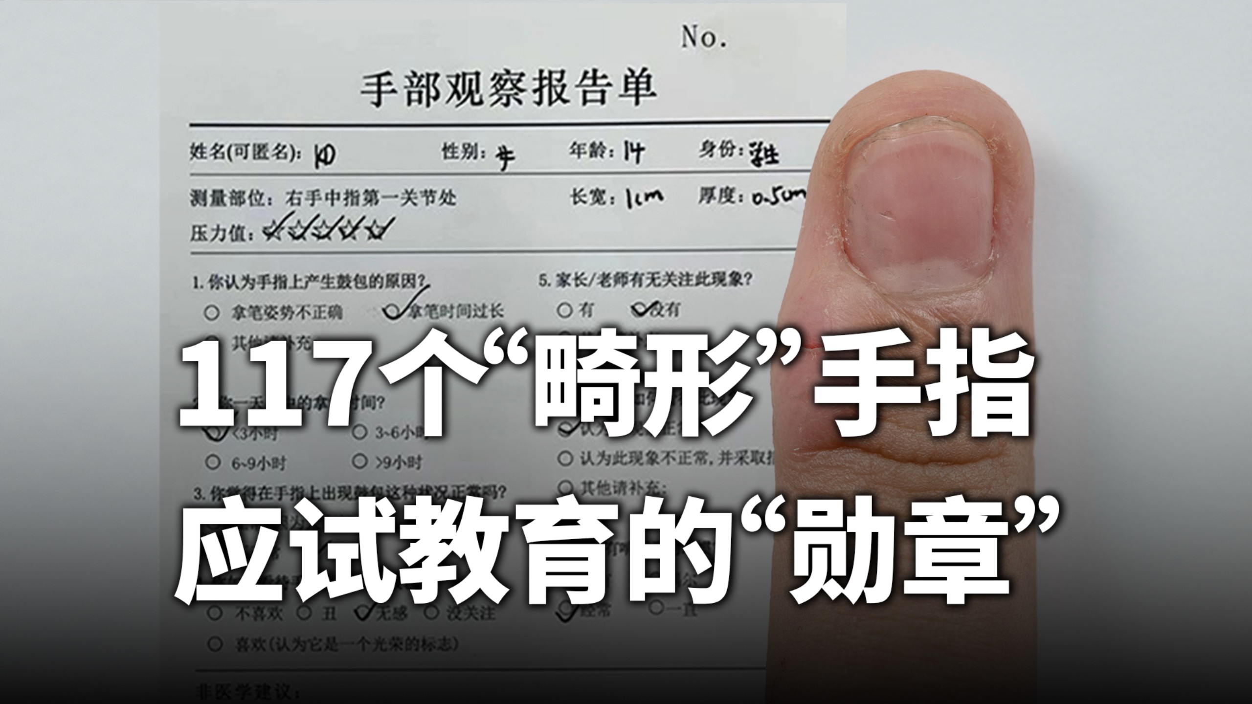 让我看看你的中指