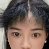 女子植发后刘海尴尬出圈，网友：这刘海太奇特了