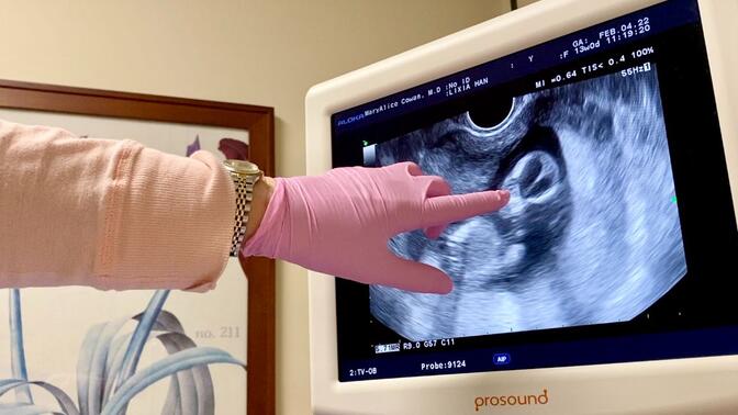 三胎的第一次产检, 宝宝性别这是可以说的吗？