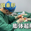膨体+超肋骨鼻 精致鼻子
