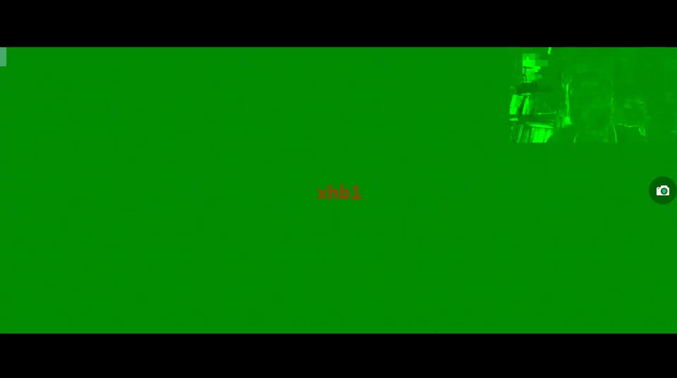 07.口外（六）第八单元 唾液腺疾病