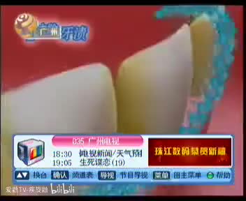 佳洁士全新升级炫白系列粤语