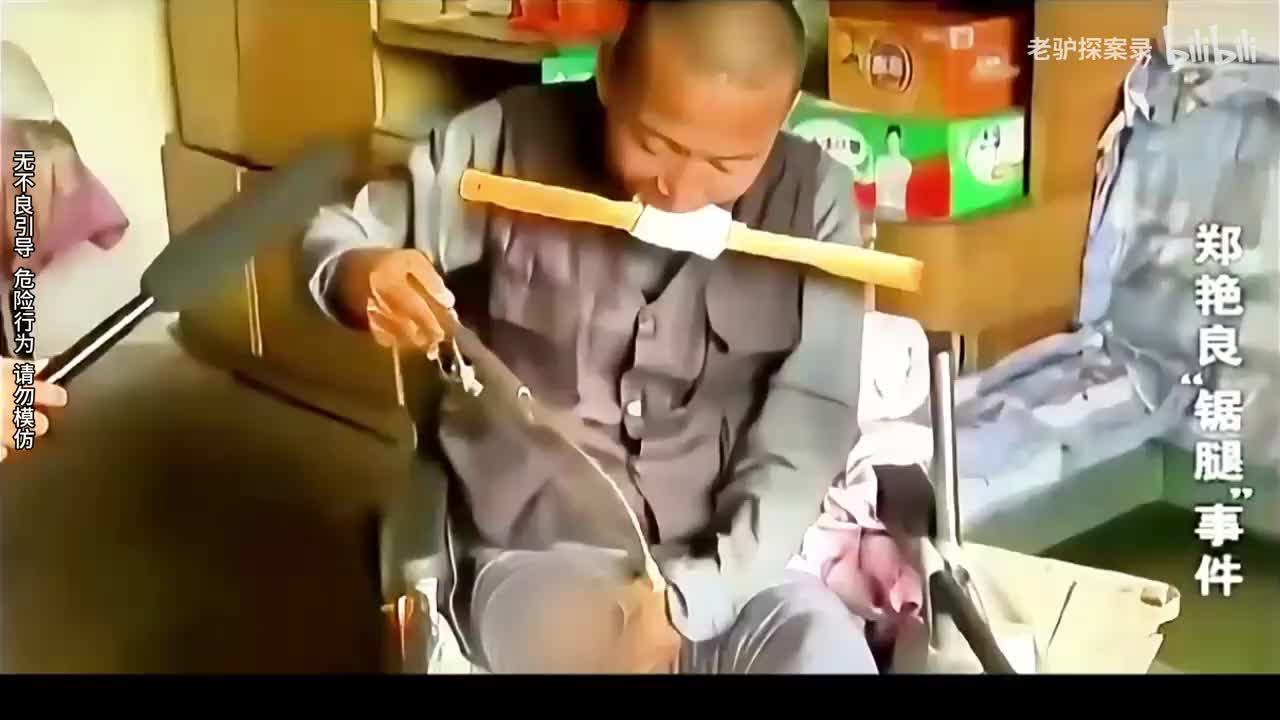 男子支付不起医药费，在家自行锯掉大腿，因剧痛咬碎四颗牙齿【老驴探案录】