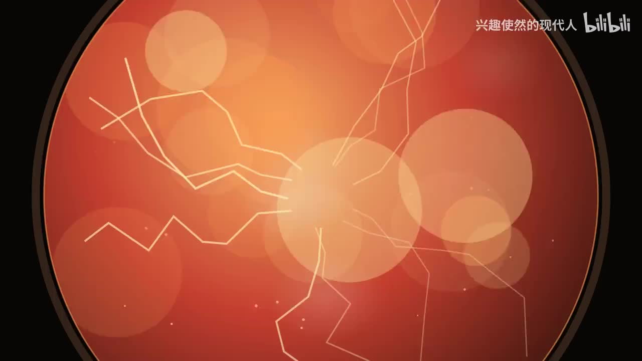 MV