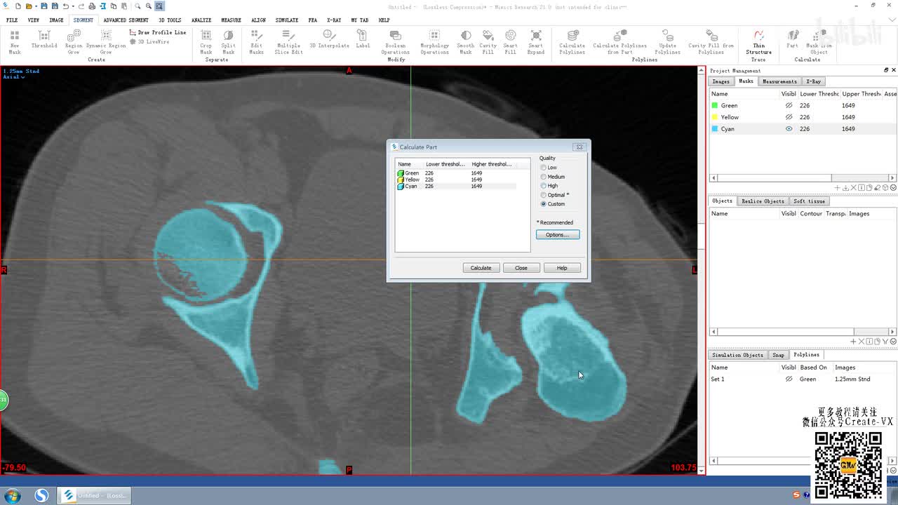 8-2、mimics21多义线(Polyline)菜单栏讲解2.mp4