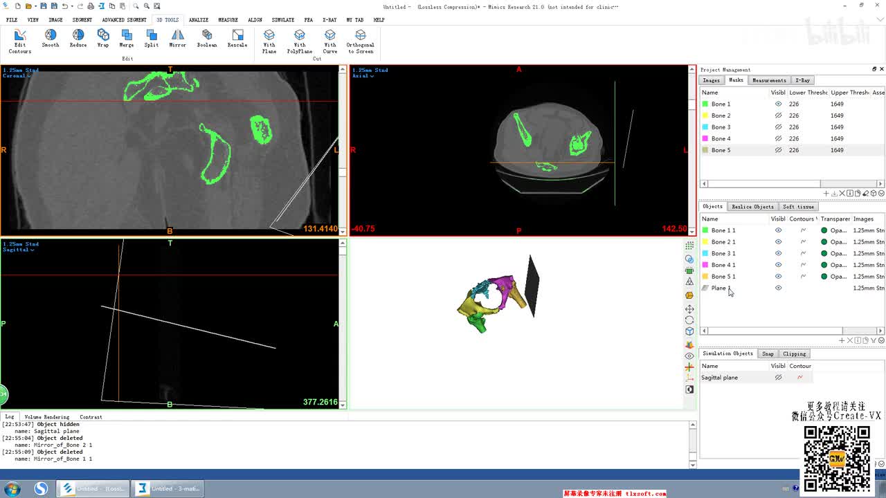 10-6、mimics21之3D tool工具栏 - boolean命令讲解