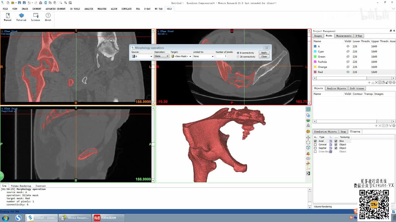 7-4、mimics21蒙版光滑（smooth）及填充（cavity fill）命令讲解
