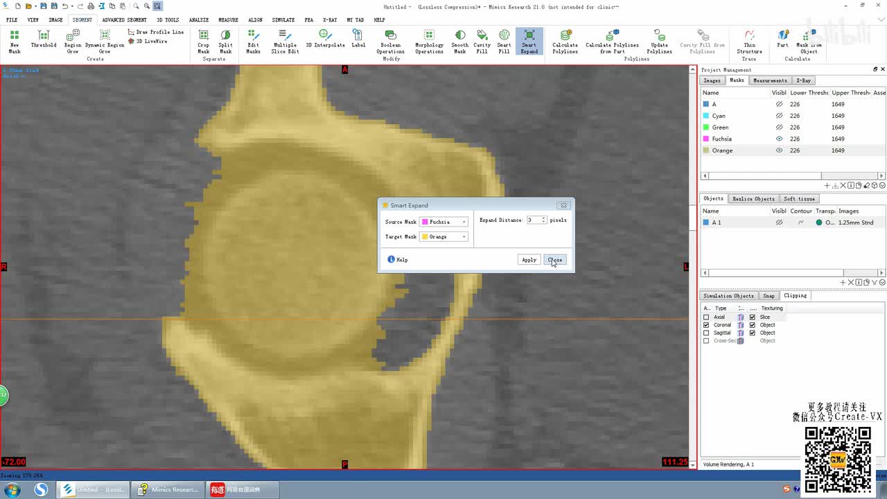7-5、mimics21计算3D实体（calculate 3D)命令讲解