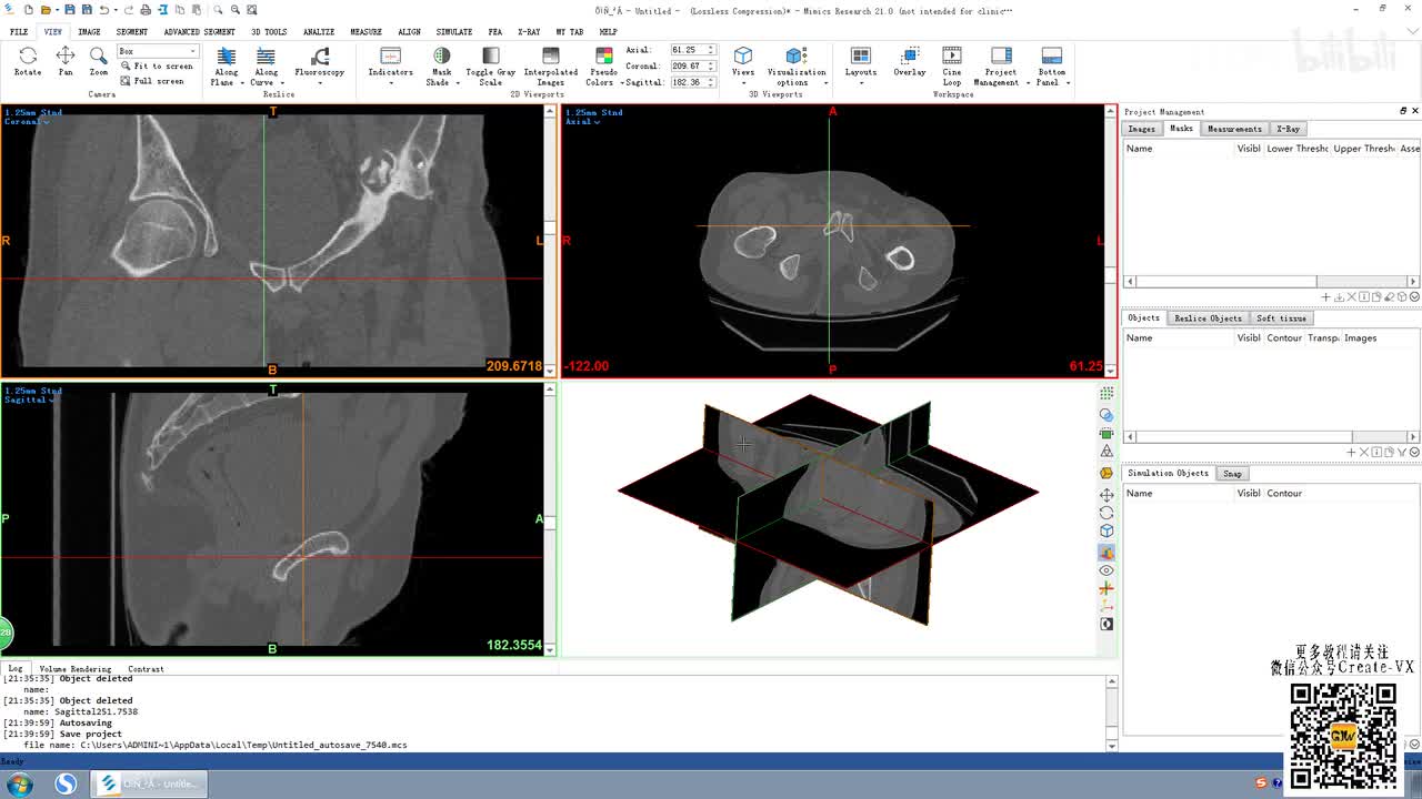 3-1、mimics21重切片（relice菜单）讲解1