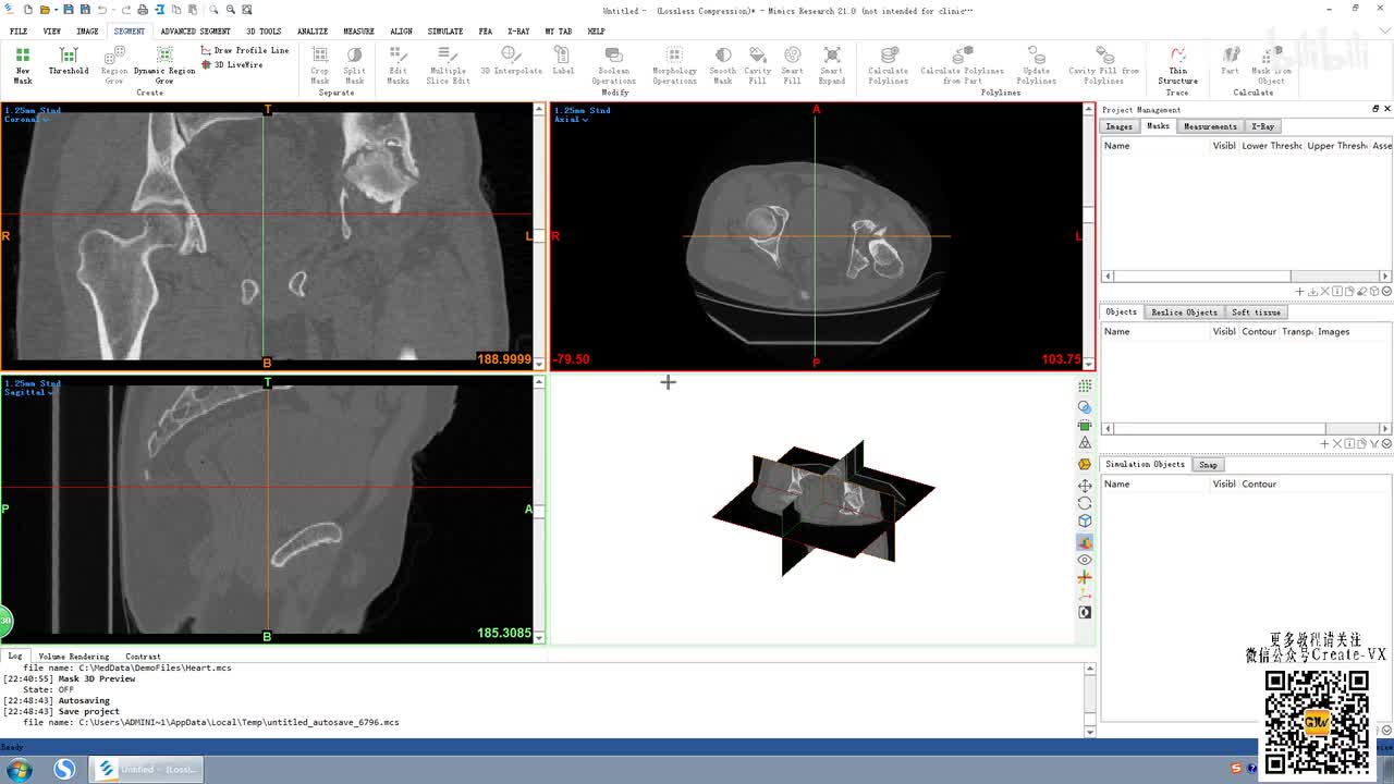 5-1、mimics21蒙版创建工具栏讲解1.mp4