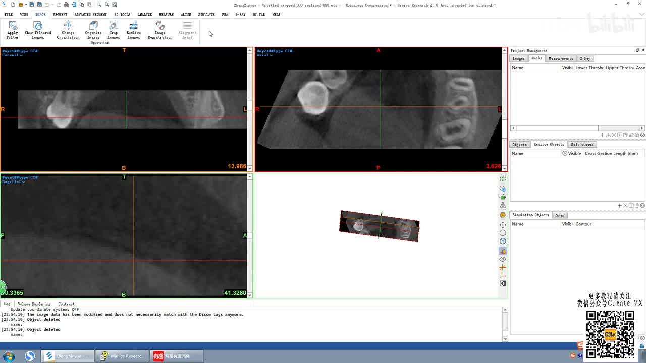 4、mimics21测量工具讲解