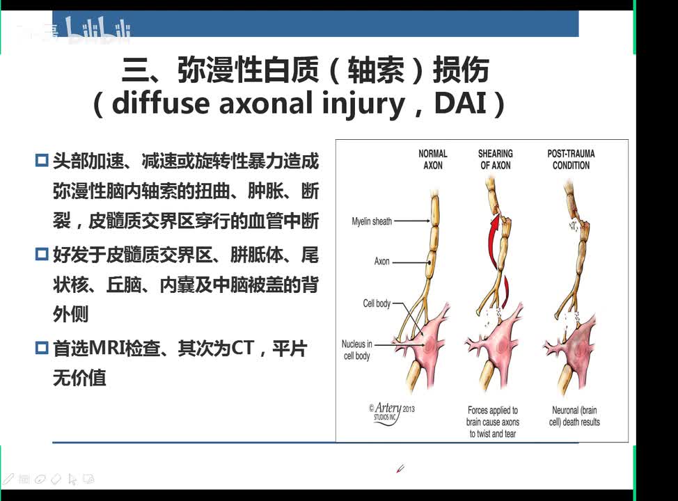 弥漫性轴索损伤