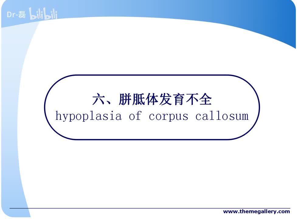 胼胝体发育不全