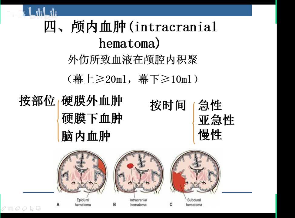 脑内血肿影像诊断