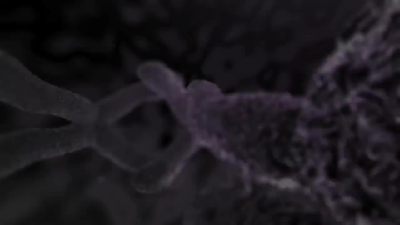 中风 56-Stroke Nucleus Health