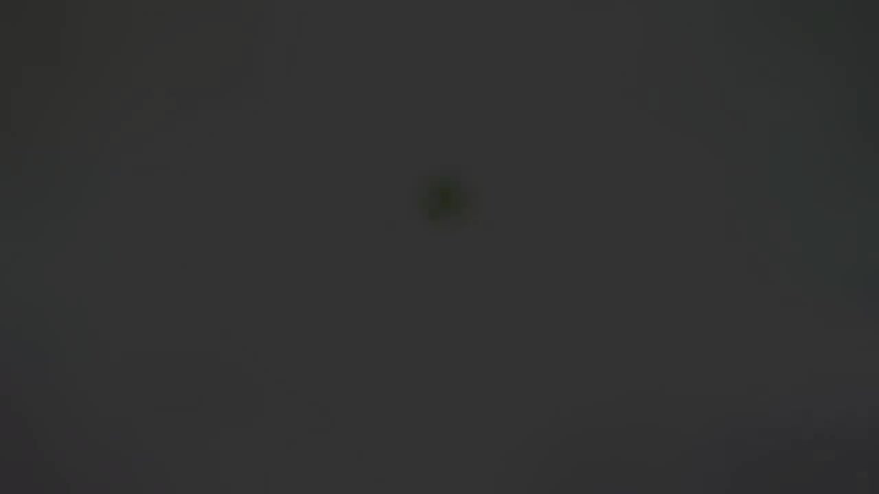 是什么原因导致GERD 26-What Causes GERD