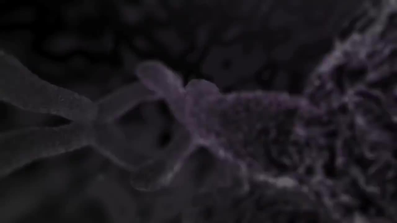 食管癌106-Esophageal Cancer