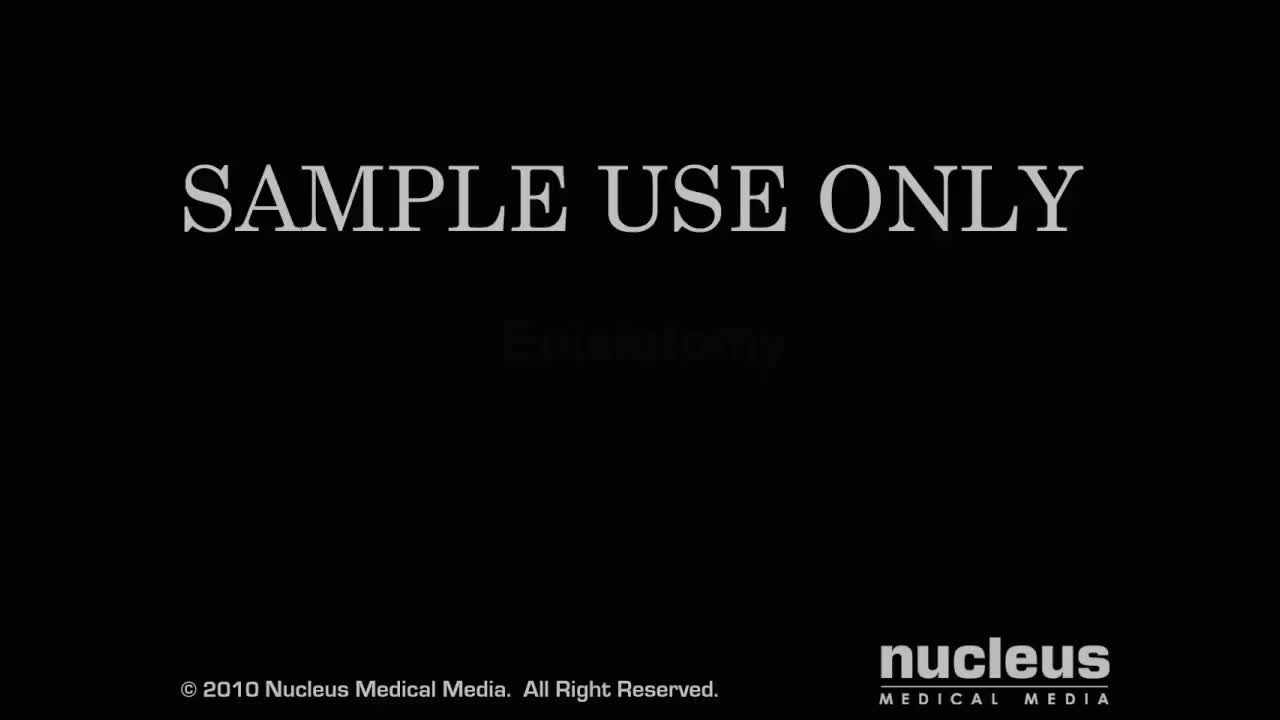 外阴切开术 105-Episiotomy