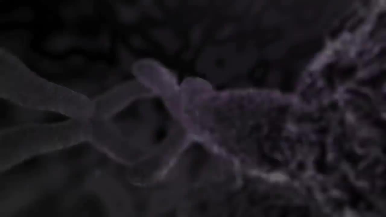 扁桃体切除术和腺样体切除术 94-Amigdalectomía y adenoidectomía