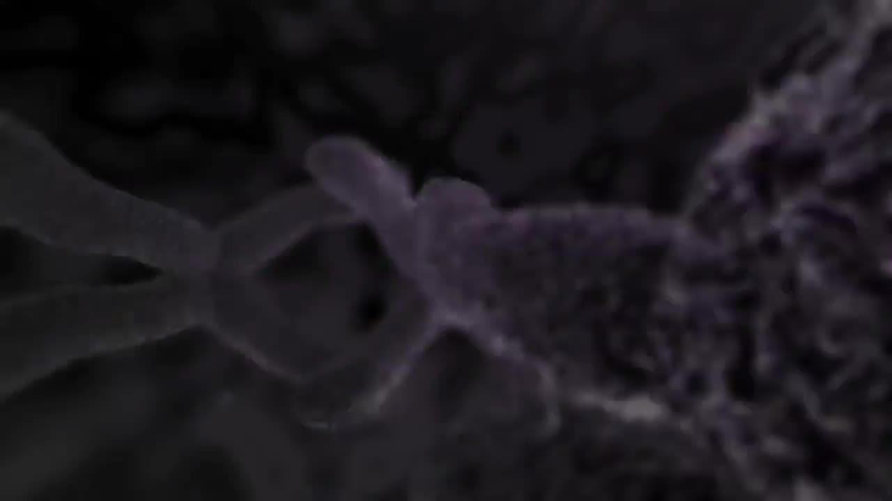 医学动画睾丸癌 82-Medical Animation Testicular Cancer