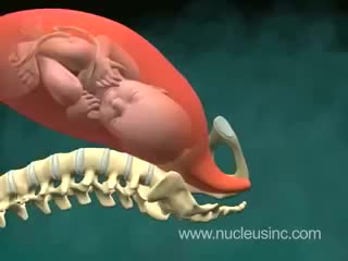 正常阴道分娩 70-Parto Vaginal Normal