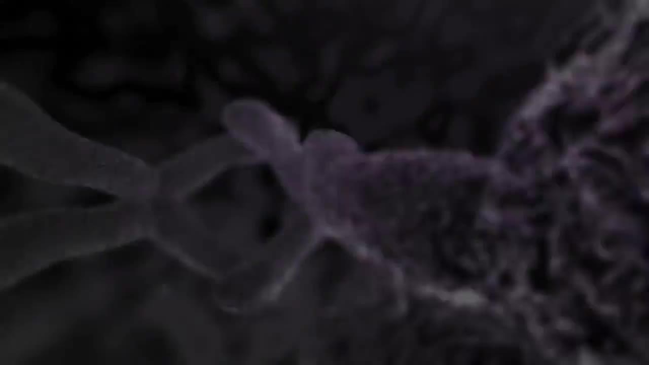 腰椎间盘损伤 103-Back Pain Lumbar Disc Injury