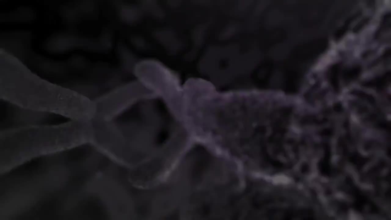 癌症治疗近距离放射疗法 83-Cancer Treatment Brachytherapy