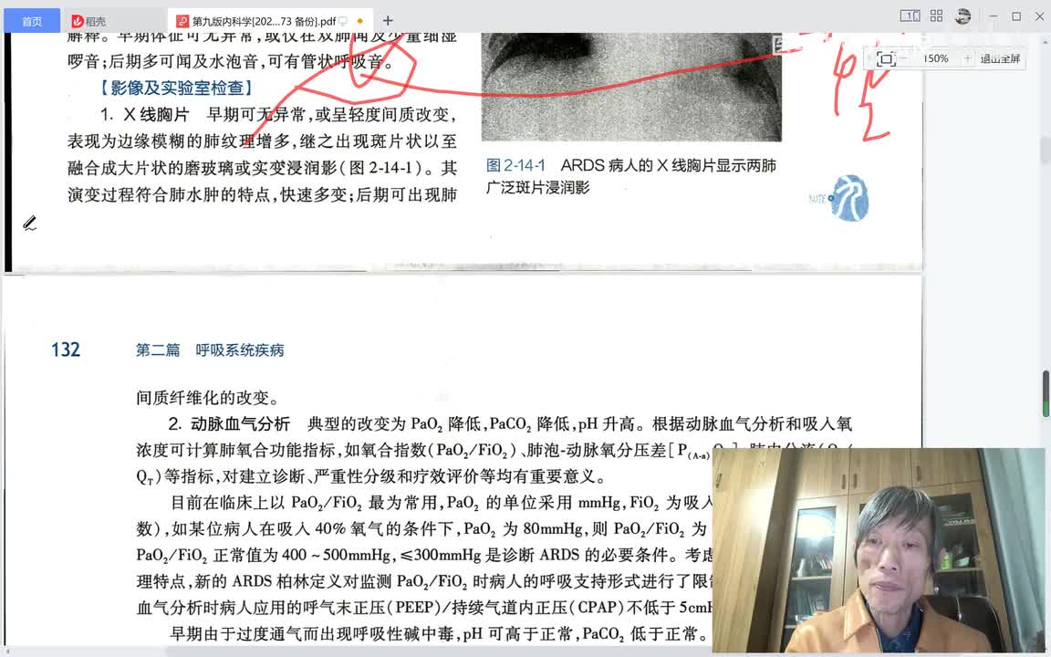 呼吸内科、第十四章、ARDS二、影像学和实验室检查，诊断及鉴别诊断，涉及面很广，建议细细品