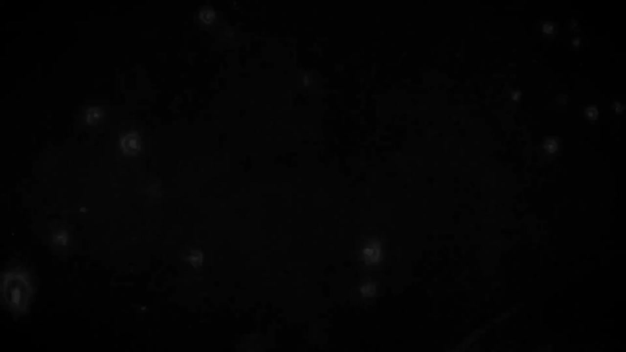 第一季ED1 美しき残酷な世界