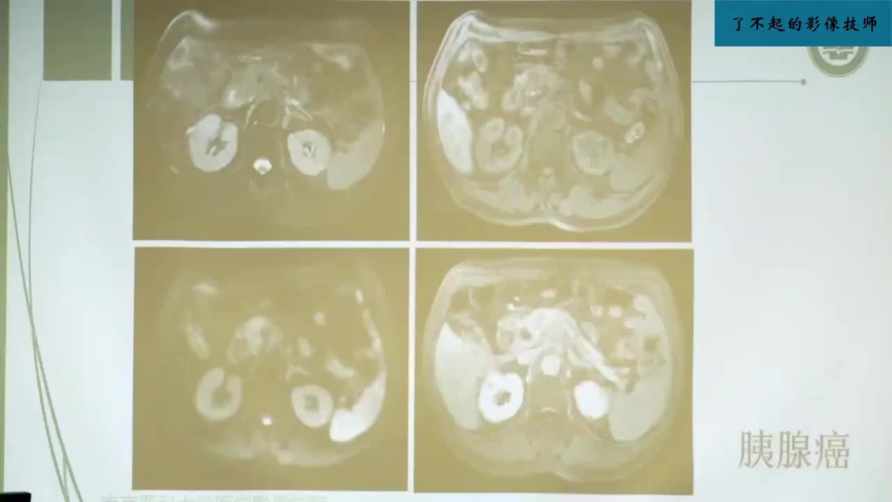 4.5 胰腺及脾脏病变2