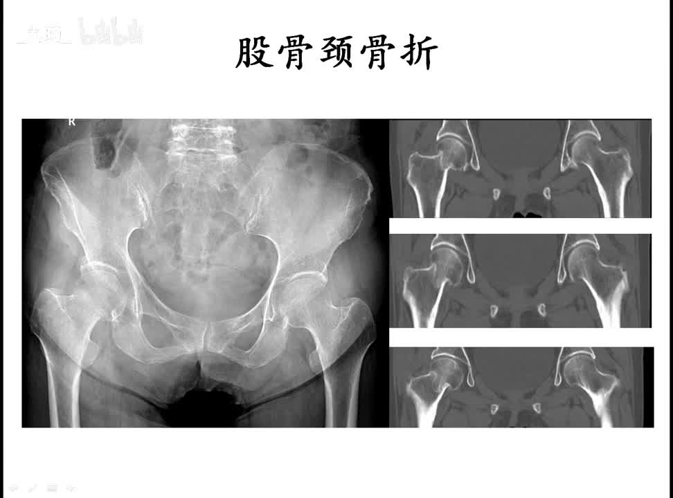 37 骨骼肌系统-5-疾病诊断2