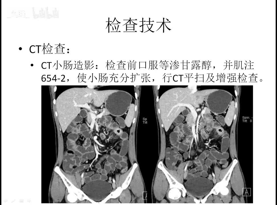 22 消化-2-消化道检查技术及正常表现
