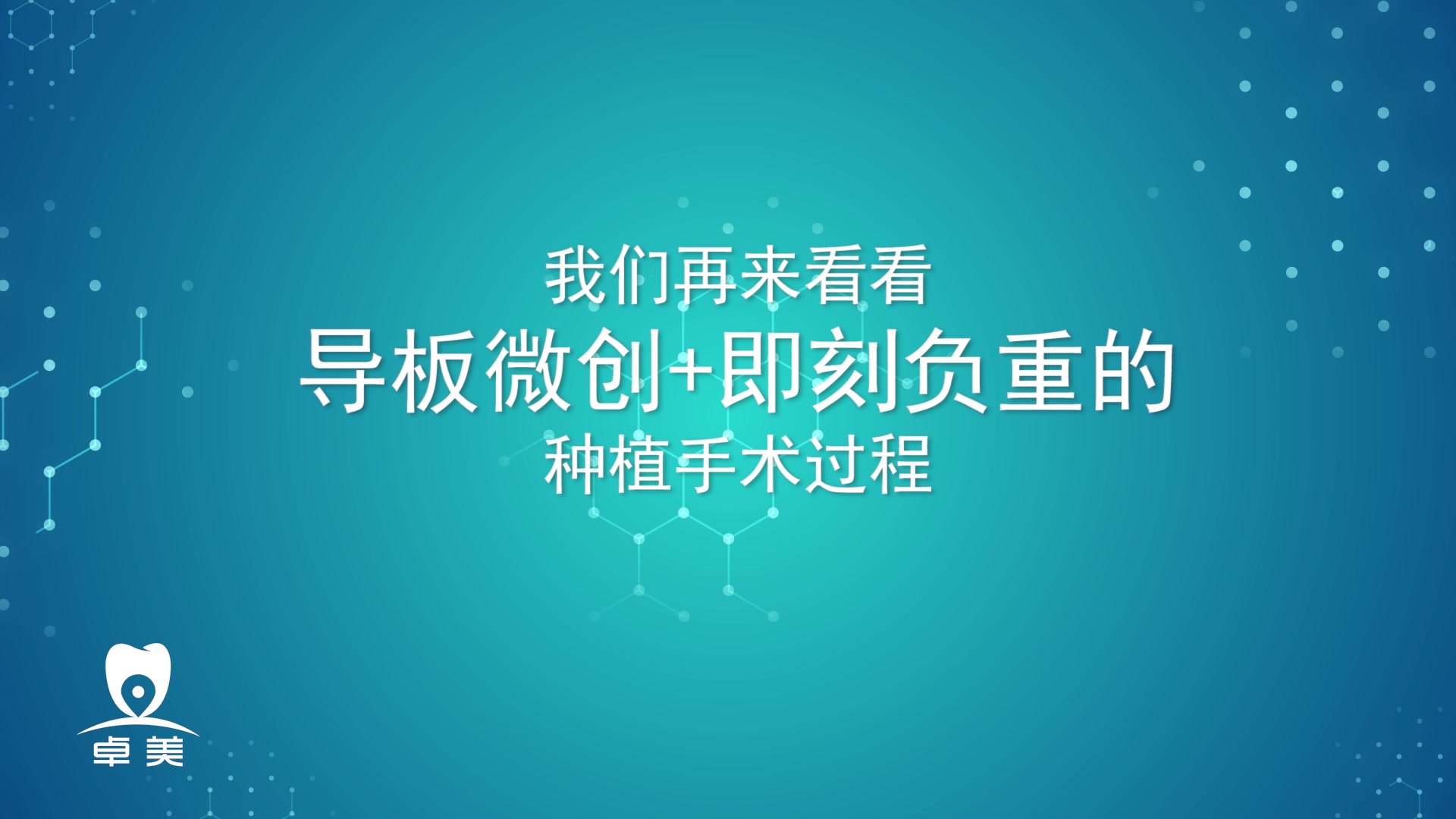 4分钟教你了解口腔传统种植与导板微创种植的区别哔哩哔哩bilibili