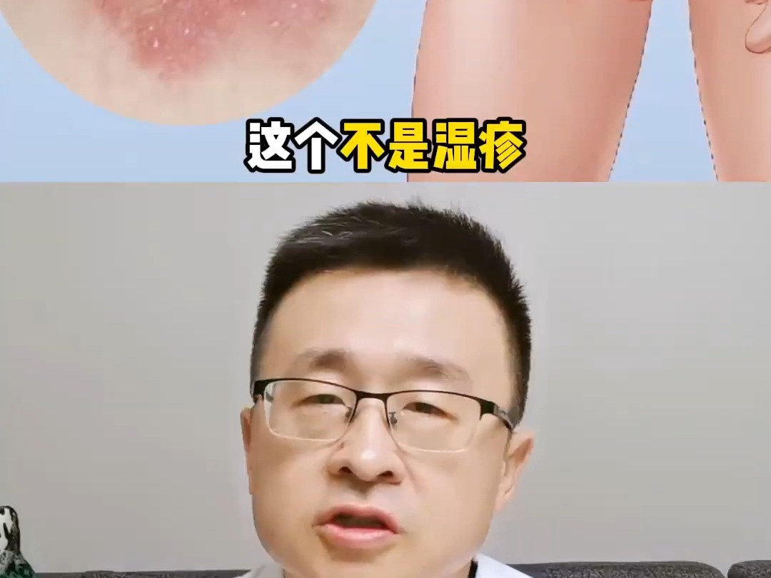 神奇股藓药,验证过的高效解决方案