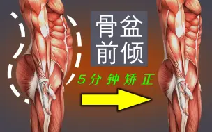 Download Video: 5分钟体态纠正训练，矫正骨盆前倾，平坦小腹！解决腰痛！