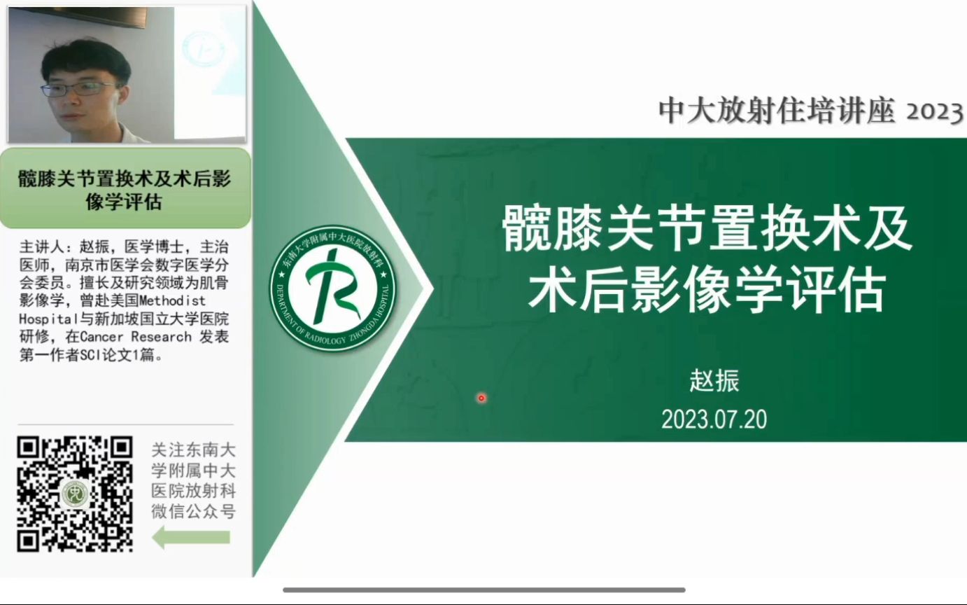 髋膝关节置换术及术后影像学评估哔哩哔哩bilibili