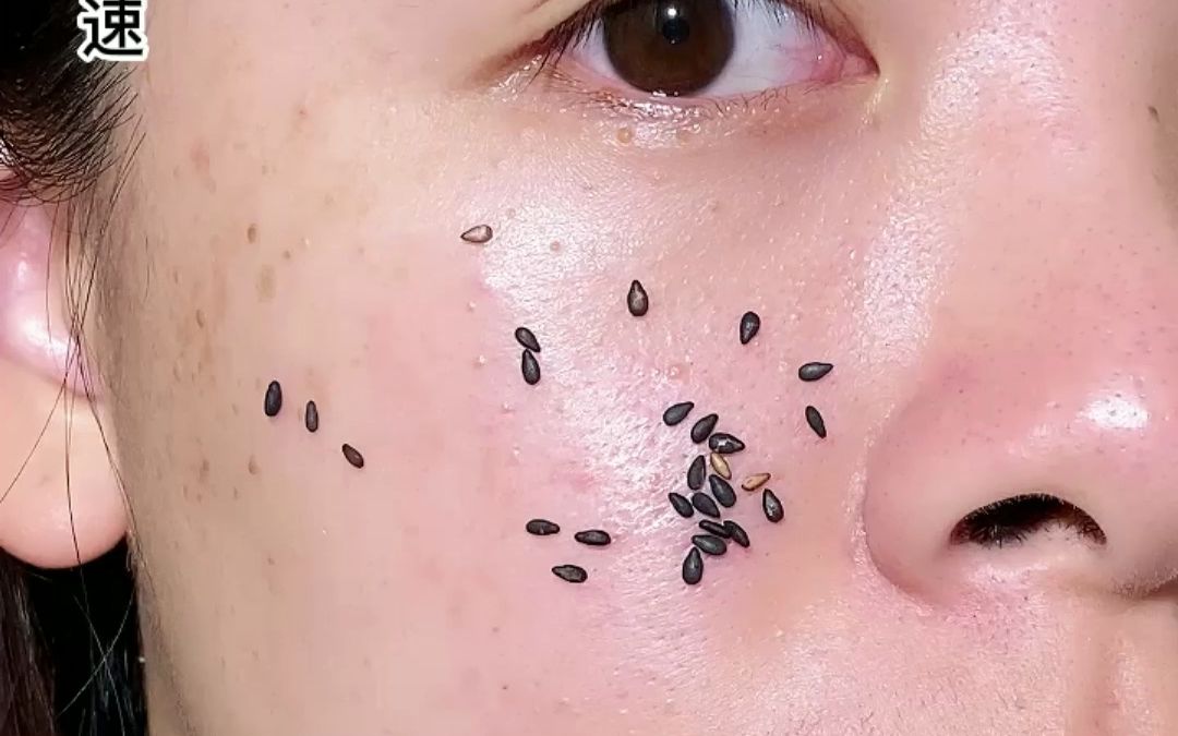 你是不是像她一样芝麻脸