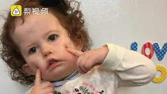 患怪病无法微笑，女孩依然乐观快乐