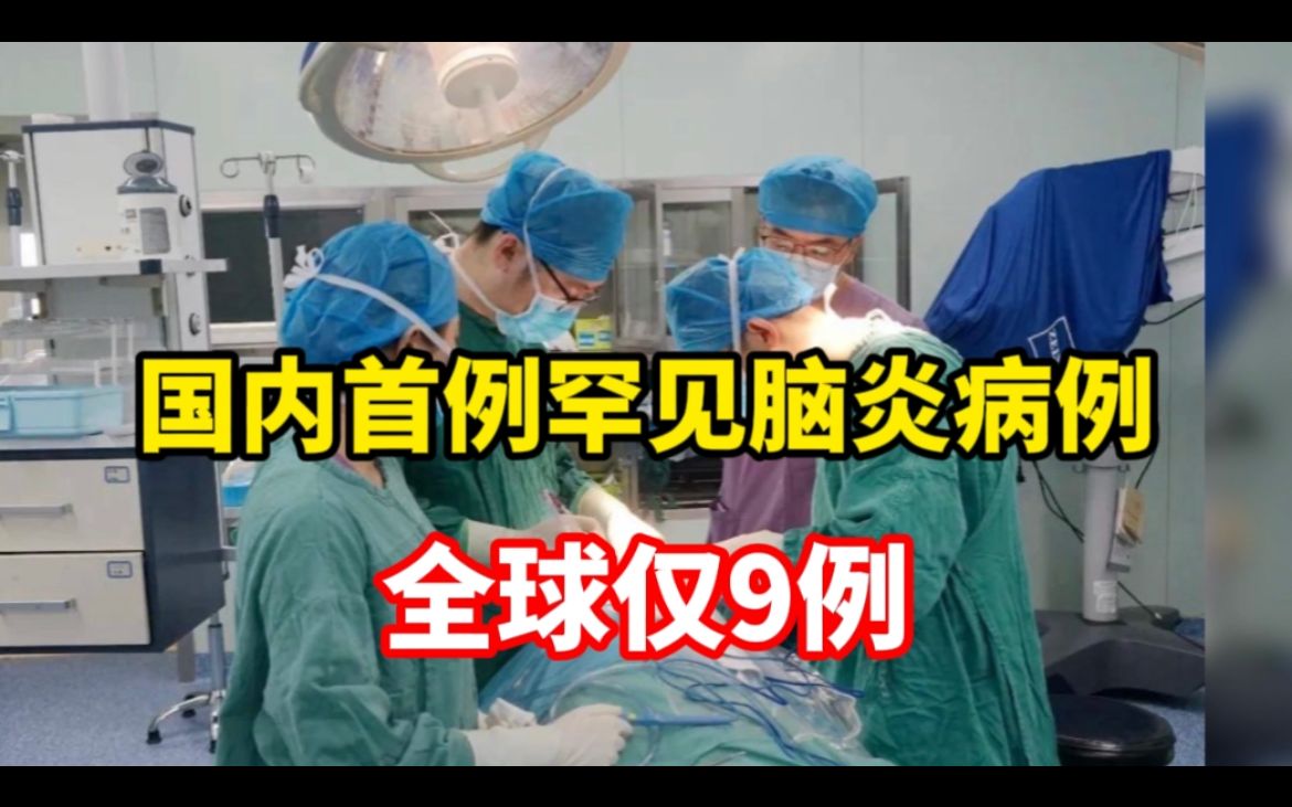 上海瑞金医院发现国内首例罕见脑炎病例,全球仅9例哔哩哔哩bilibili