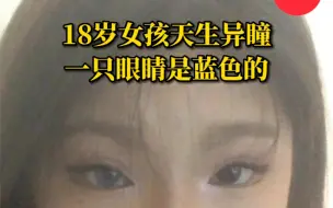 Download Video: 18岁女孩天生一只眼睛是蓝瞳 曾被骂“怪物”，现在已学会欣赏自己