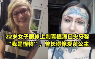 Video herunterladen: 22岁女子眼球上刺青植满口尖牙称“我是怪物”，曾长得像爱莎公主