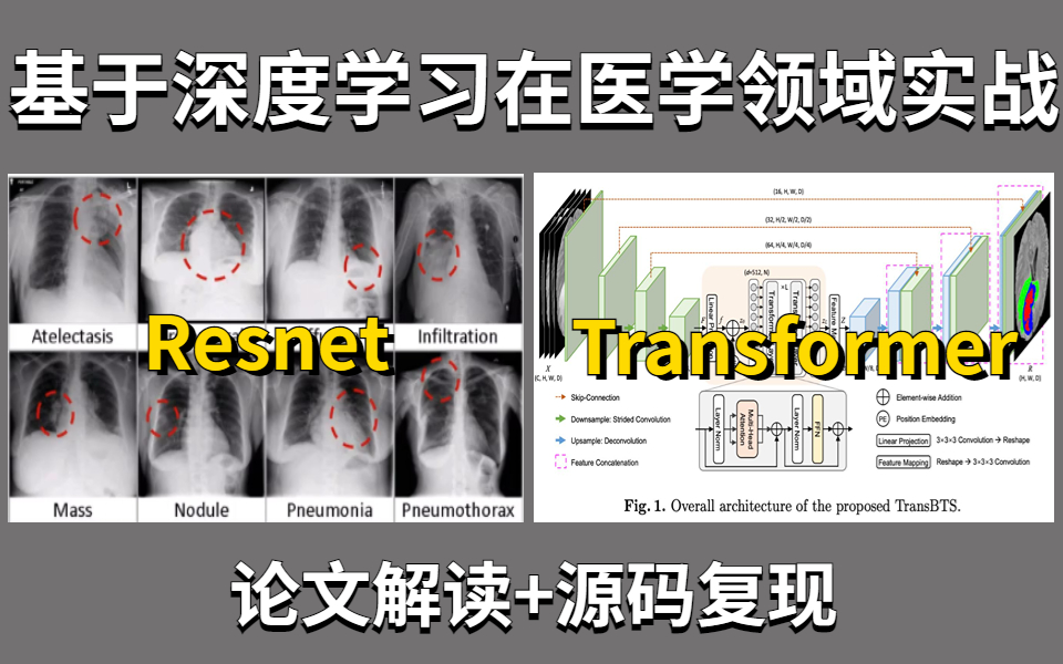 基于深度学习在医学领域实战:Resnet+Transformer!数据集分类实战+医学分割领域拓展应用!论文解读+源码复现,比刷剧还爽!哔哩哔哩bilibili