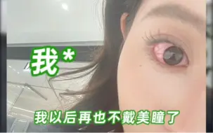 Descargar video: 烂眼警告⚠️不要乱带美瞳‼️真的会🦐