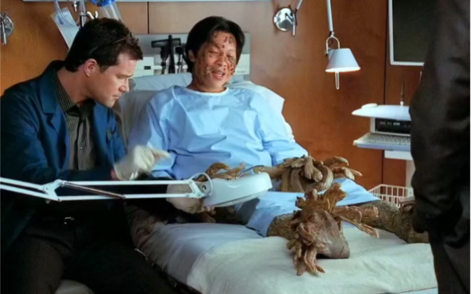 男人得了罕见的树人症