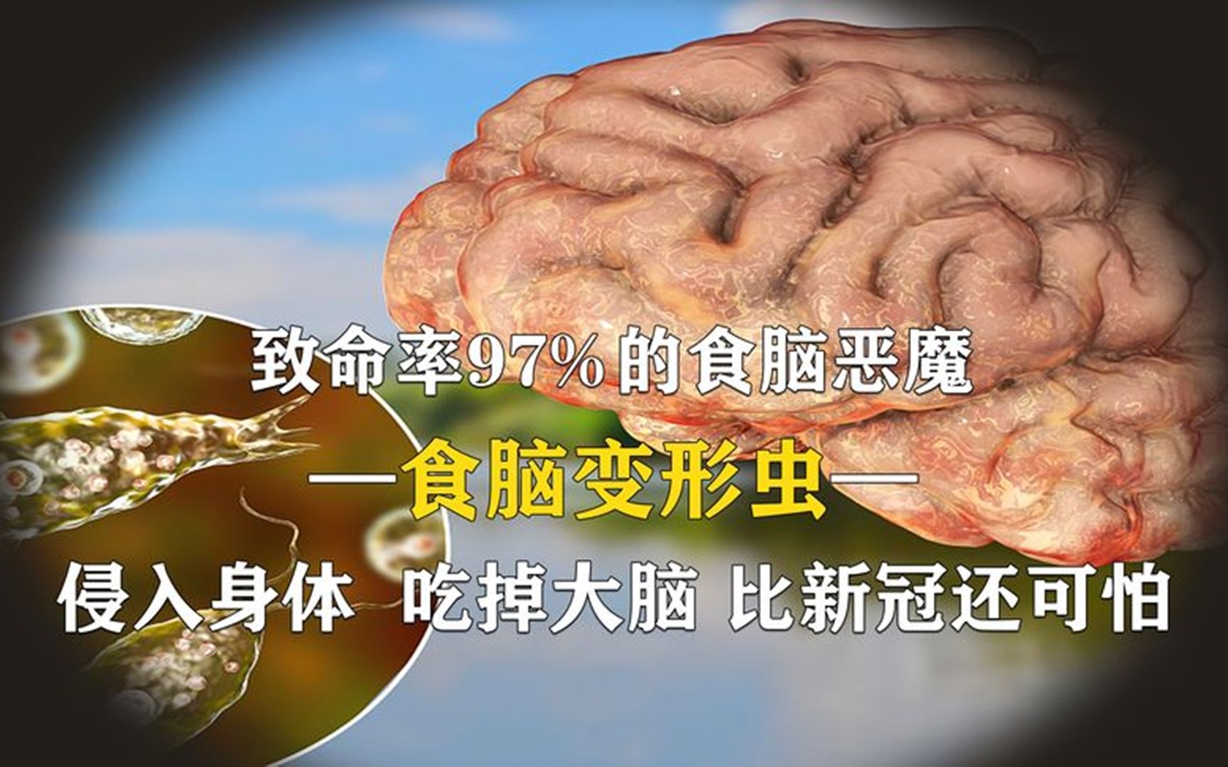 致命的食脑恶魔,死亡率高达97%,游泳时大脑是如何被吃掉的