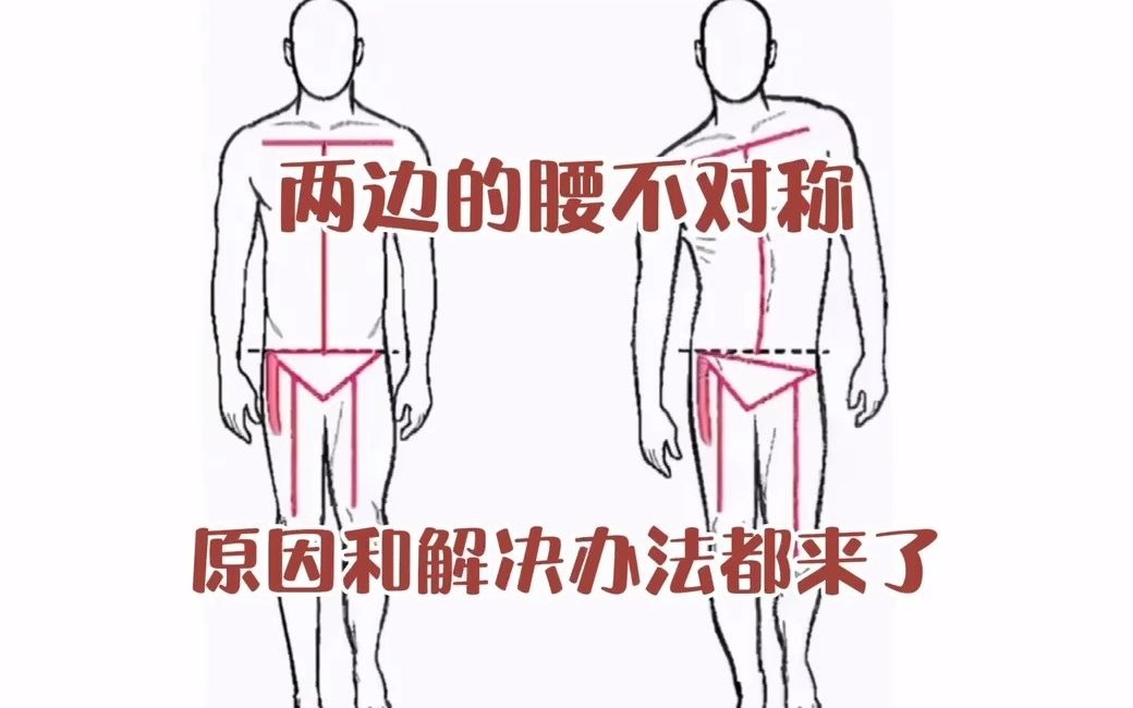 【体态矫正】两边的腰部不对称?原因和解决办法都来了.