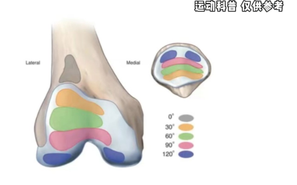 [图]三步鉴别膝盖不敢下蹲